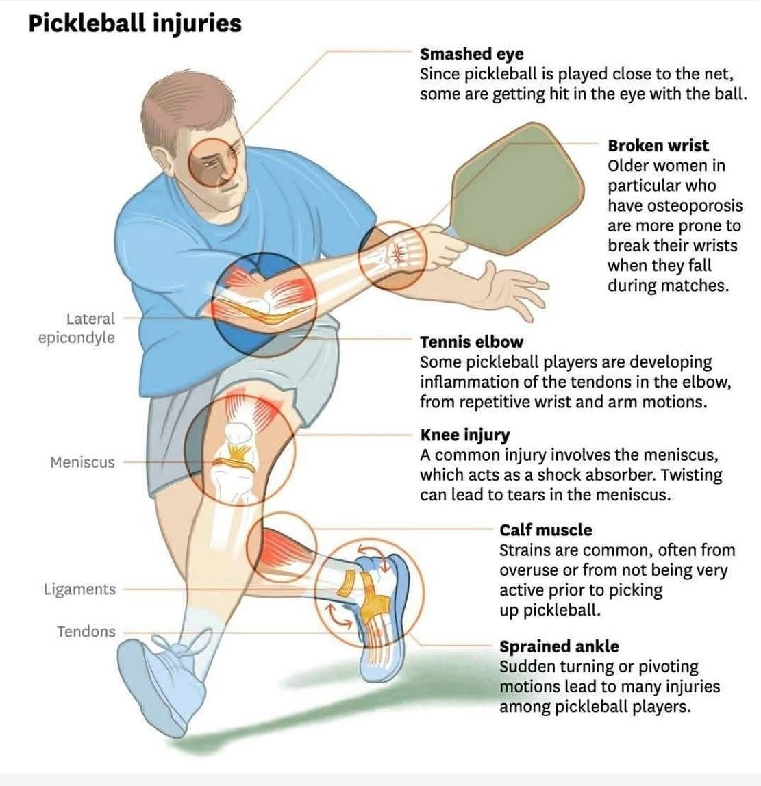 Pickleball Safety Glasses